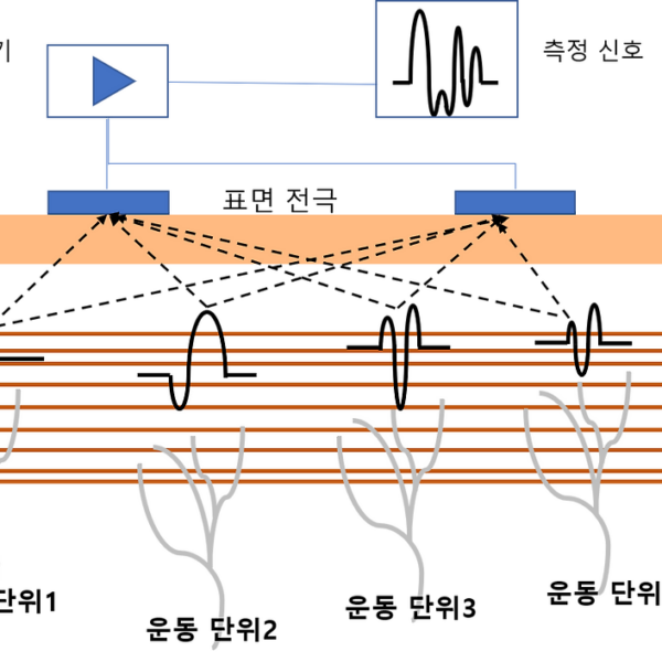 표면근전도(surface electromyography, sEMG) 원리와 활용분야